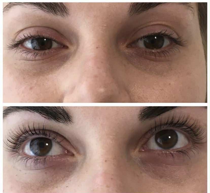 Lash lifting